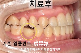 수술후