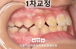 수술후