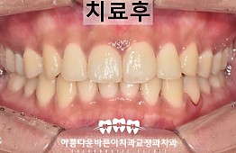 수술후