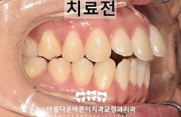 수술전