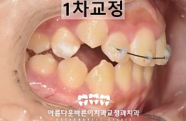 수술후