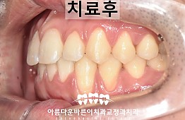 수술후