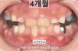 수술후