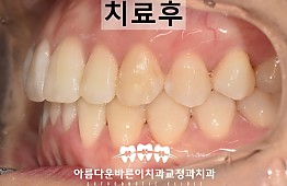 수술후