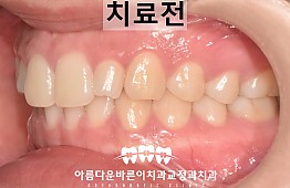 수술전