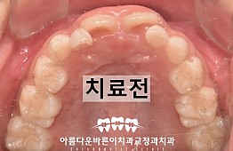 수술전