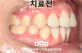 수술전