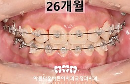 수술후