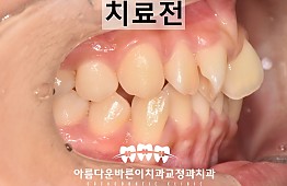 수술전