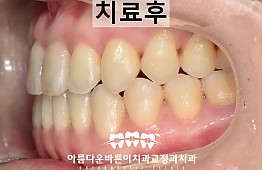 수술후