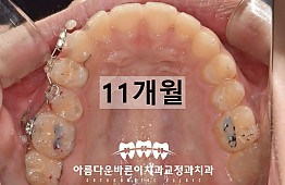 수술후