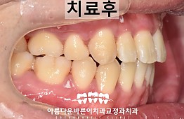 수술후