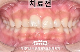 수술전