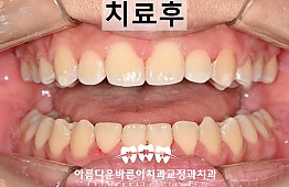 수술후