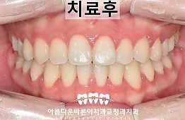 수술후