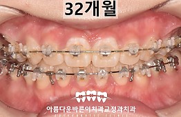 수술후