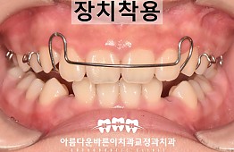 수술후