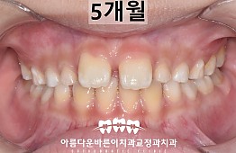 수술후