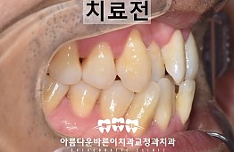 수술전