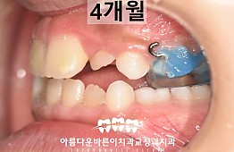 수술후