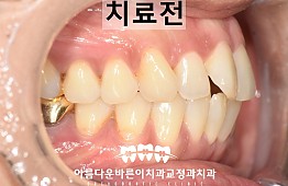 수술전