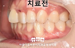 수술전