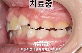 수술후