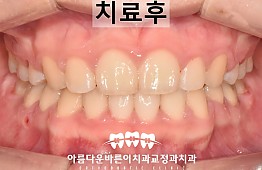 수술후