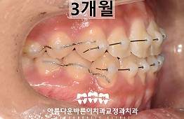 수술후