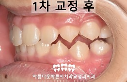 수술후