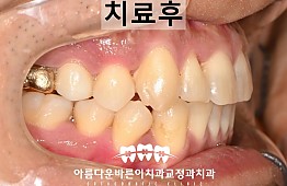 수술후