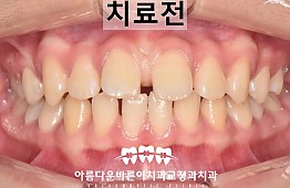 수술전