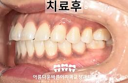 수술후