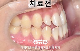 수술전