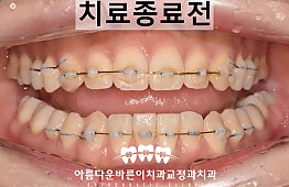 수술후