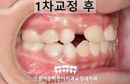 수술후