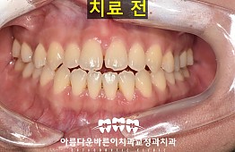 수술전