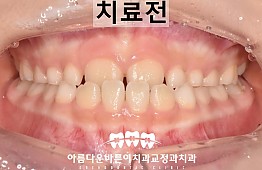 수술전