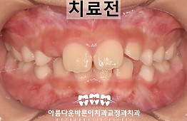 수술전