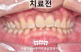 수술전