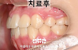 수술후