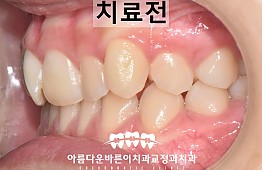 수술전