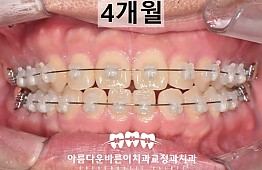 수술후