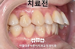 수술전