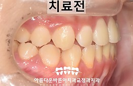 수술전