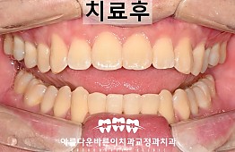 수술후