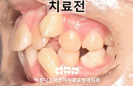 수술전