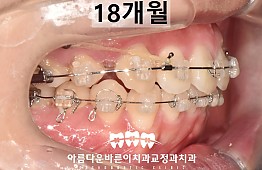 수술후