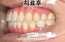 수술후