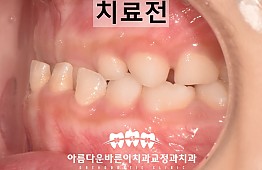 수술전